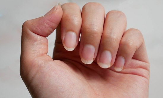 Treats Brittle Nails